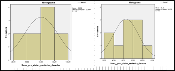 Gráfico, Histograma

Descripción generada automáticamente